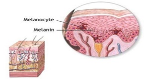 007-WHAT-IS-POST-INFLAMMATORY-HYPERPIGMENTATION-