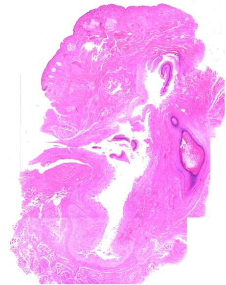 [Figure 3. Histological image (x12.5)]