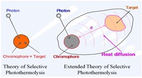 selective photothermolysis 02