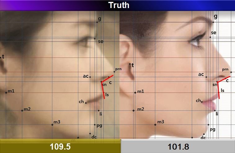 3-2. Facial Profile Analysis