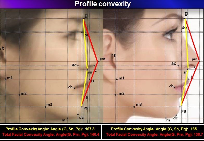 3-3. Facial Profile Analysis